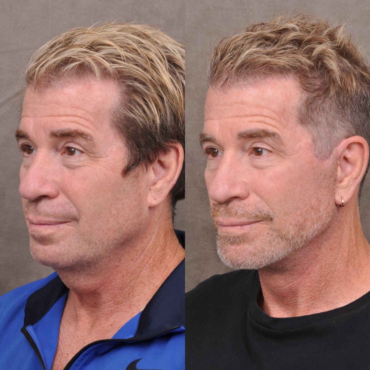 WSJ: Айтівці Кремнієвої долини роблять підтяжки, щоб не втратити роботу через вік