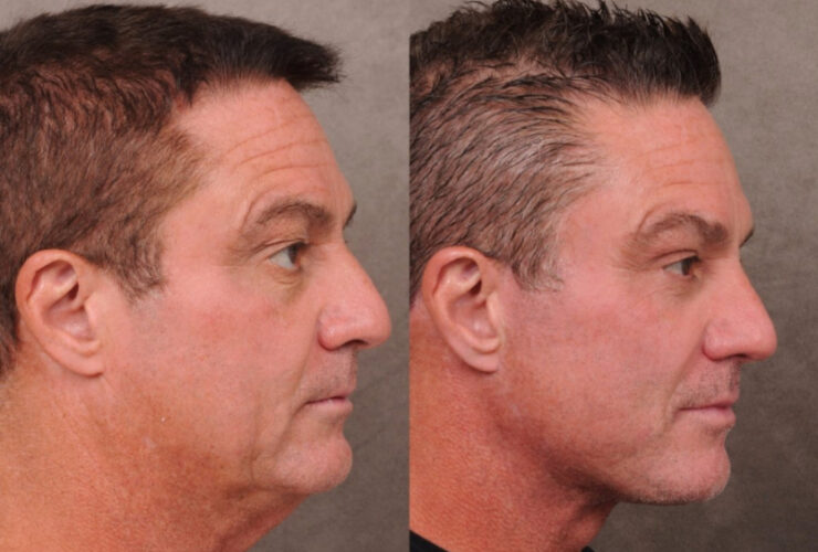 691279b96b4ffbc1c46f8b3ddedcce20