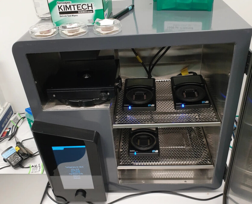 На комп'ютері з клітинами людського мозку спробували ліки від епілепсії &mdash; що з цього вийшло