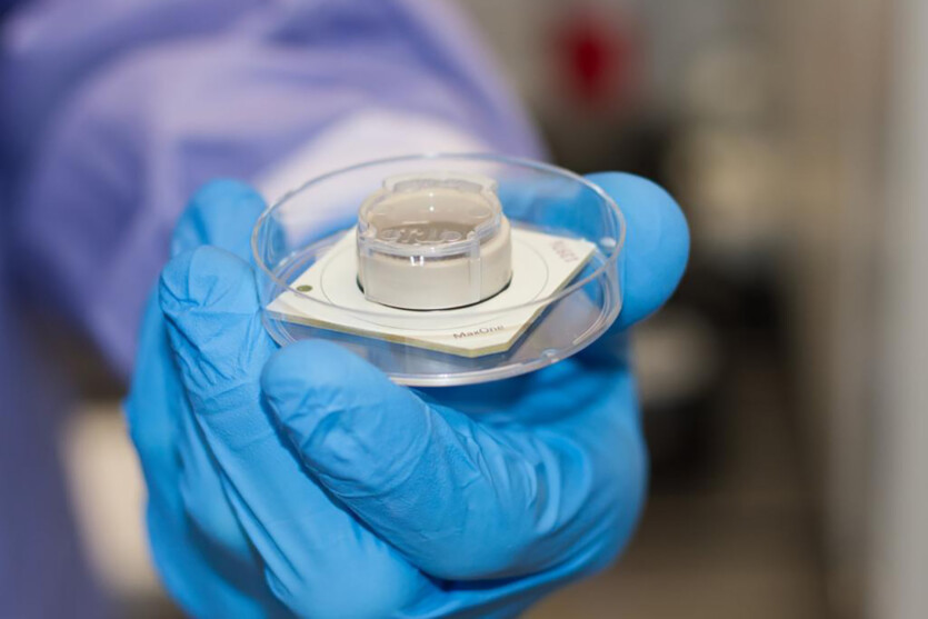 На комп'ютері з клітинами людського мозку спробували ліки від епілепсії &mdash; що з цього вийшло